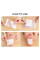 Пластыри на стопы Киноки для вывода токсинов Kinoki Cleansing Detox Foot Pads очищающие