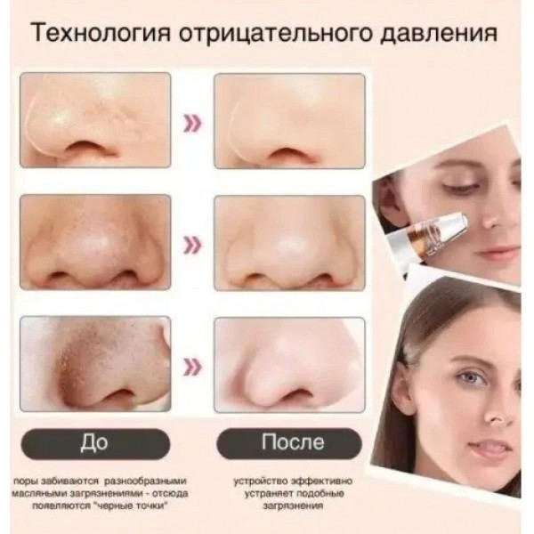 Аппарат для вакуумной глубокой чистки пор лица Multi-Functional, Вакуумный аппарат очиститель кожи и пор