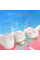 2в1 ультразвуковая зубная щётка-скалер Electric Sonic Dental Scaler с зеркалом и сменными насадками